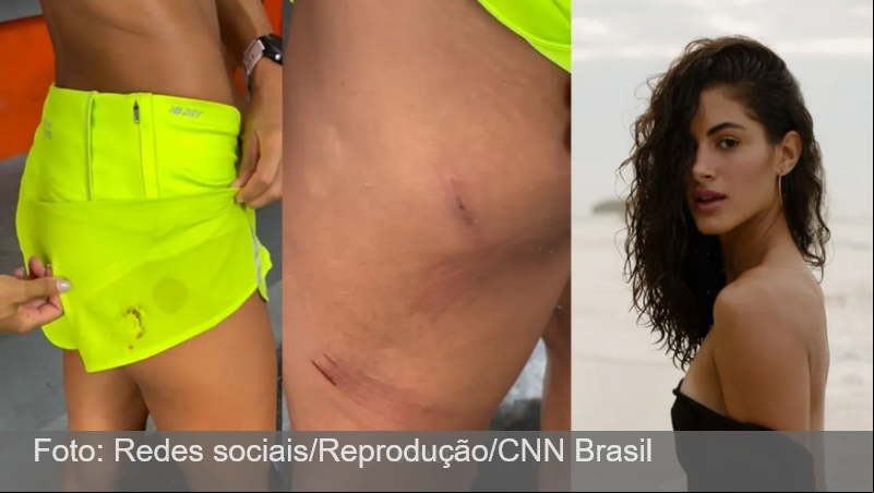 Atriz é atacada por cinco cães em orla de praia do RJ